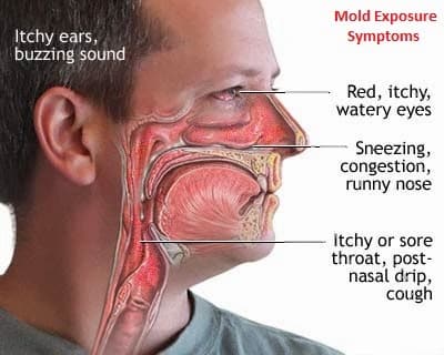 Mold-symptoms