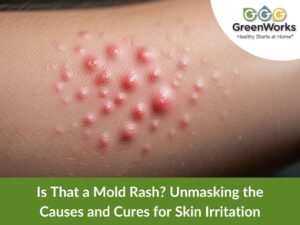 Is that a mold rash? Unmasking the causes and cures for skin irritation 3